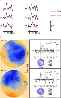 An Event-Related Brain Potential (ERP) Study of Complex Anaphora in Spanish